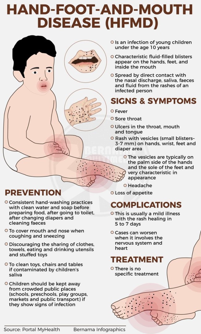 Hfmd Rash Beginning Health officials confirm Hand, Foot, and Mouth Disease (HFMD) and ...
